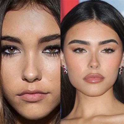 Did Madison Beer Have Plastic Surgery: A Dive into the World of Celebrity Transformations and Public Speculation